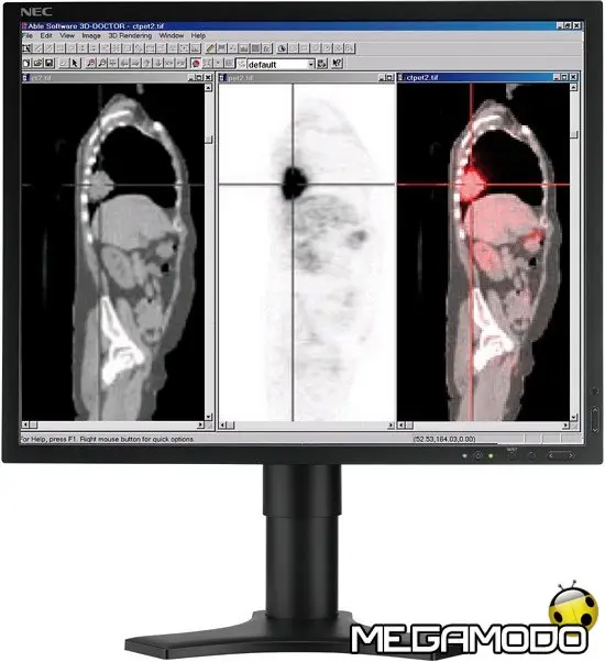 NEC MD21M, immagini a colori per la diagnostica medica