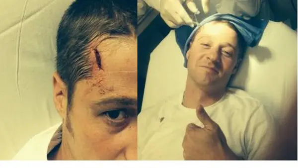 “Gotham”: Benjamin McKenzie ferito sul set